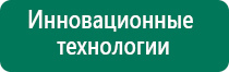 Носки электроды характеристика